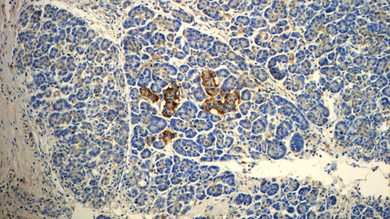 Immunohistochemistry of paraffin-embedded human pancreas slide using Catalog No:113710(PYY Antibody) at dilution of 1:50