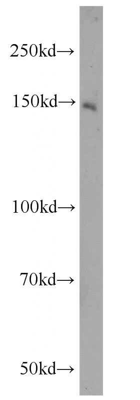 HeLa cells were subjected to SDS PAGE followed by western blot with Catalog No:117002(ZNF541 antibody) at dilution of 1:800