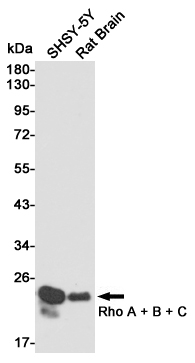 Western blot analysis of Rho A + B + C expression in SHSY-5Y and Rat Brain cell lysates using Rho A + B + C antibody at 1/1000 dilution.Predicted band size:22KDa.Observed band size:22KDa.