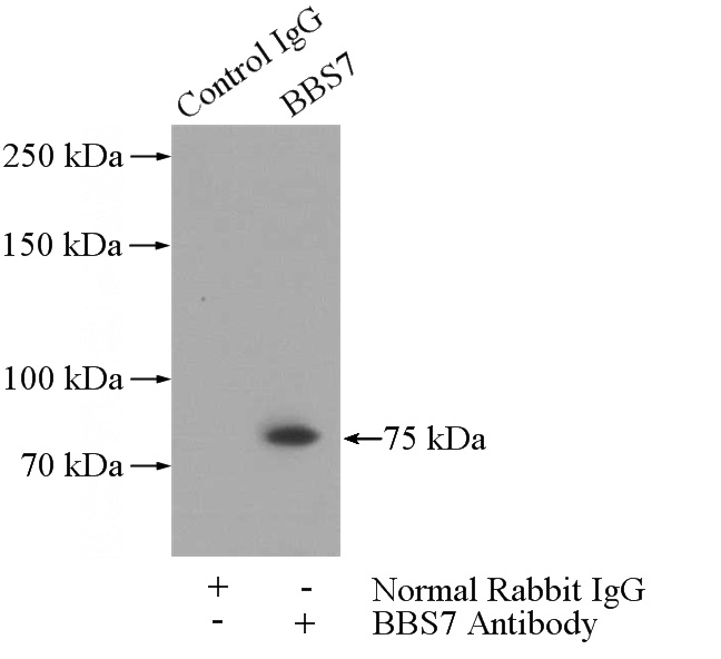 IP Result of anti-BBS7 (IP:Catalog No:108375, 4ug; Detection:Catalog No:108375 1:500) with mouse testis tissue lysate 4000ug.