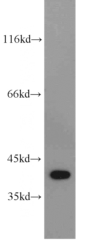 HeLa cells were subjected to SDS PAGE followed by western blot with Catalog No:109920(DHPS antibody) at dilution of 1:300