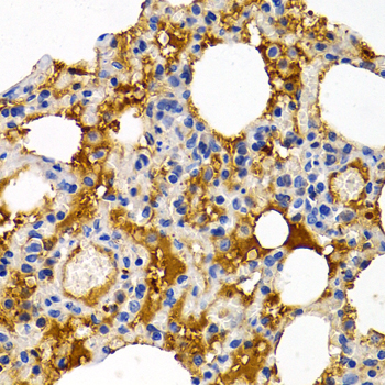 Immunohistochemistry - TFF1 Polyclonal Antibody 