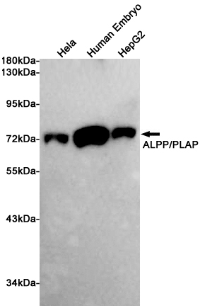 Western blot detection of ALPP/PLAP in Hela,Human Embryo,HepG2 cell lysates using ALPP/PLAP (3C11) Mouse mAb(1:1000 diluted).Predicted band size:58KDa.Observed band size:70KDa.