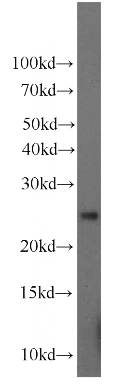 A375 cells were subjected to SDS PAGE followed by western blot with Catalog No:107883(GFER antibody) at dilution of 1:1000