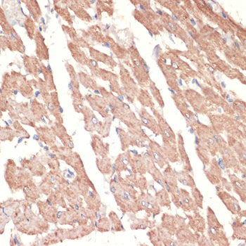 Immunohistochemistry - ADRA1A Polyclonal Antibody 