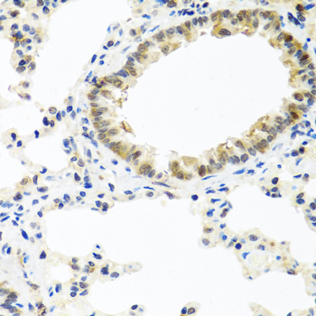 Immunohistochemistry - BMP5 Polyclonal Antibody 