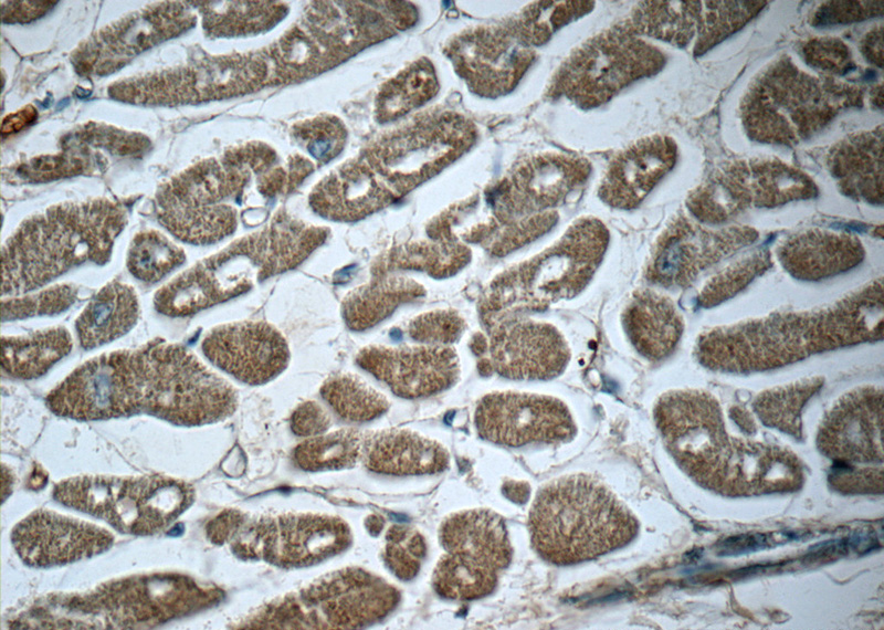 Immunohistochemistry of paraffin-embedded human heart slide using Catalog No:116096(TMEM127 Antibody) at dilution of 1:50