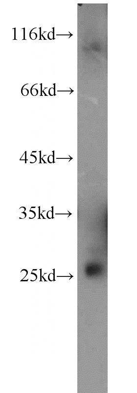 human brain tissue were subjected to SDS PAGE followed by western blot with Catalog No:114441(RAB3B antibody) at dilution of 1:800