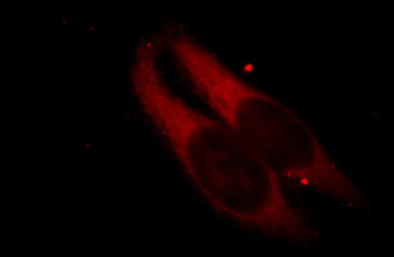 Immunofluorescent analysis of Hela cells, using BCAP31 antibody Catalog No:108421 at 1:25 dilution and Rhodamine-labeled goat anti-rabbit IgG (red).