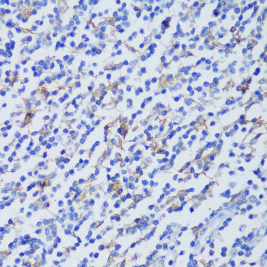 Immunohistochemistry - EFHD2 Polyclonal Antibody 