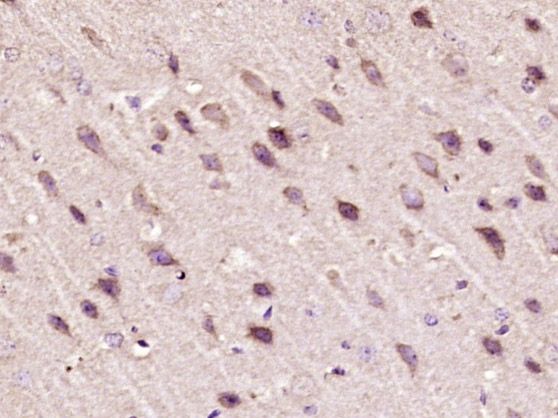 Fig2: Paraformaldehyde-fixed, paraffin embedded (mouse brain tissue); Antigen retrieval by boiling in sodium citrate buffer (pH6.0) for 15min; Block endogenous peroxidase by 3% hydrogen peroxide for 20 minutes; Blocking buffer (normal goat serum) at 37℃ for 30min; Antibody incubation with (PTPD1) Polyclonal Antibody, Unconjugated at 1:400 overnight at 4℃, followed by operating according to SP Kit(Rabbit) (sp-0023) instructionsand DAB staining.