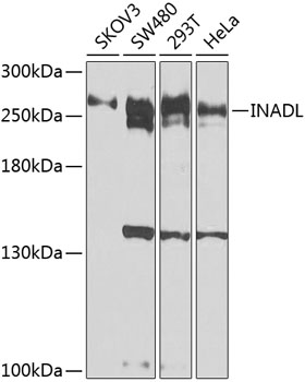 Western blot - INADL Polyclonal Antibody 
