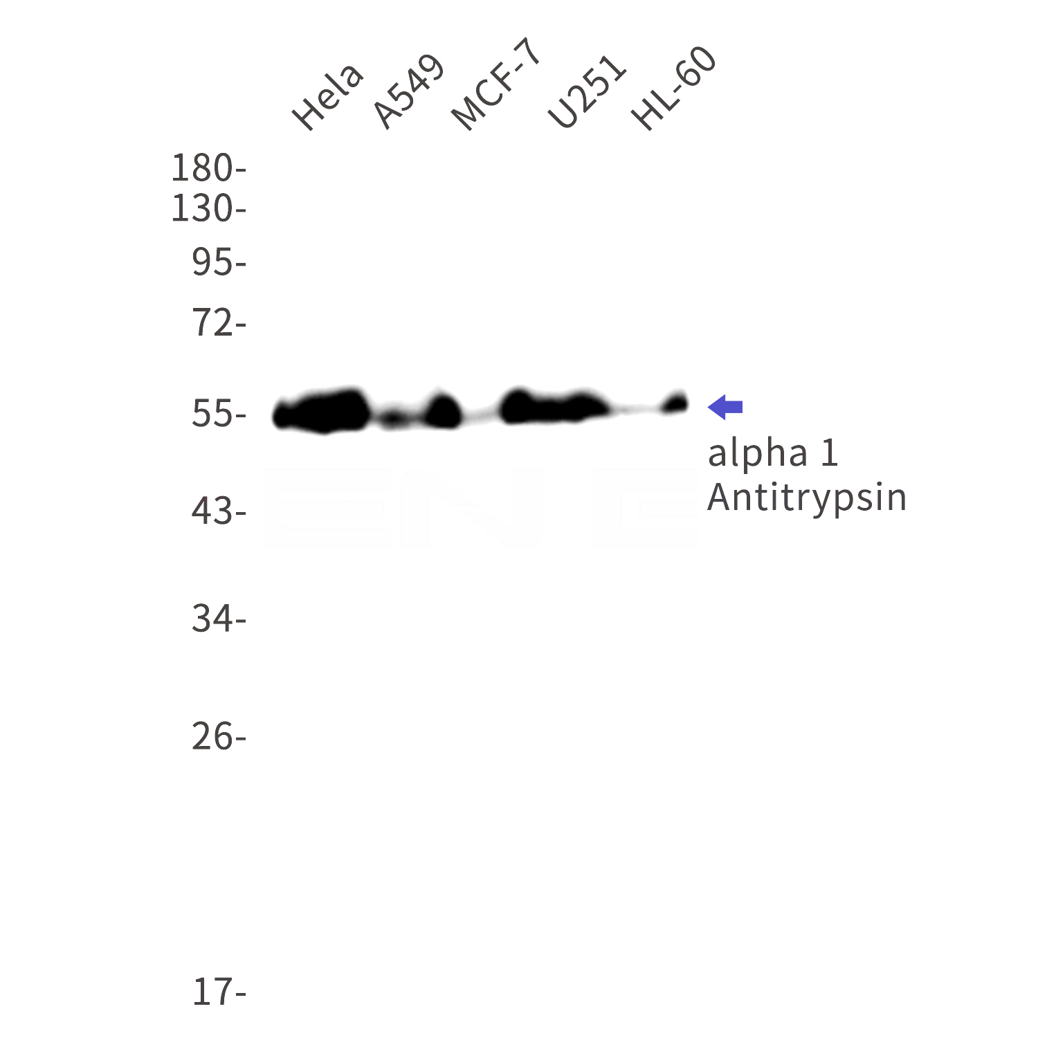 Western blot detection of alpha 1 Antitrypsin in Hela,A549,MCF-7,U251,HL-60 cell lysates using alpha 1 Antitrypsin Rabbit mAb(1:1000 diluted).Predicted band size:46kDa.Observed band size:55kDa.