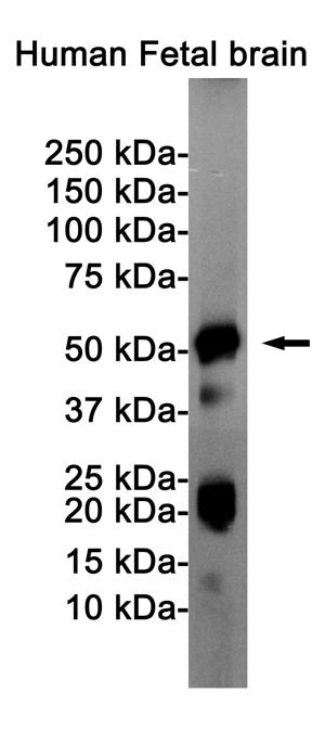 Western blot detection of Tau (Phospho-Ser404) in Human Fetal brain cell lysates using Tau (Phospho-Ser404) Rabbit pAb(1:1000 diluted).Predicted band size:79KDa.Observed band size:50-80KDa.