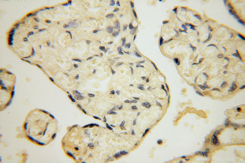 Immunohistochemical of paraffin-embedded human placenta using Catalog No:114078(PPA2 antibody) at dilution of 1:100 (under 40x lens)