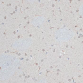 Immunohistochemistry - ZNF415 Polyclonal Antibody 