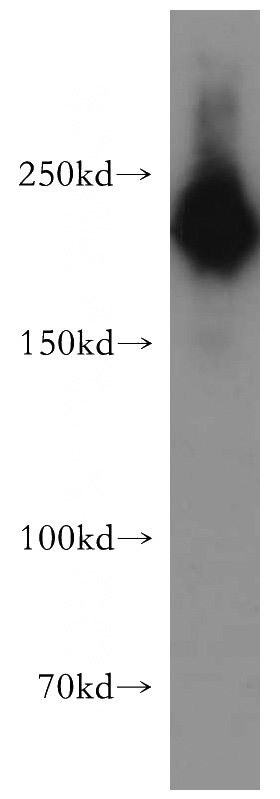 mouse brain tissue were subjected to SDS PAGE followed by western blot with Catalog No:112929(MYH10 antibody) at dilution of 1:1500