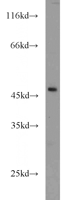 HEK-293 cells were subjected to SDS PAGE followed by western blot with Catalog No:108059(ANGPTL5 antibody) at dilution of 1:500