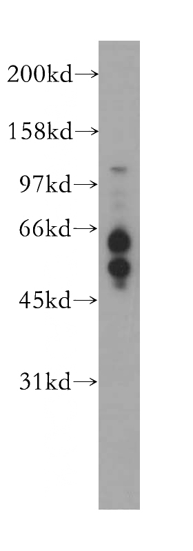 mouse testis tissue were subjected to SDS PAGE followed by western blot with Catalog No:114593(RBBP8 antibody) at dilution of 1:300