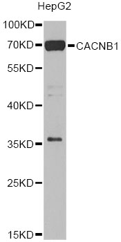 Western blot - CACNB1 Polyclonal Antibody 