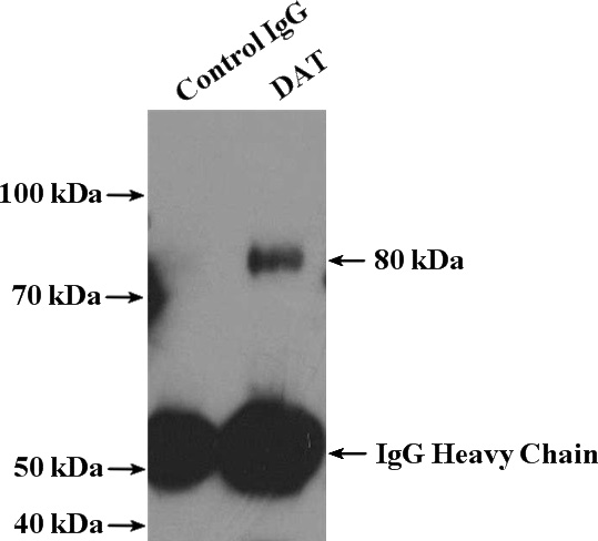 IP Result of anti-SLC6A3 (IP:Catalog No:109869, 4ug; Detection:Catalog No:109869 1:600) with mouse brain tissue lysate 4000ug.