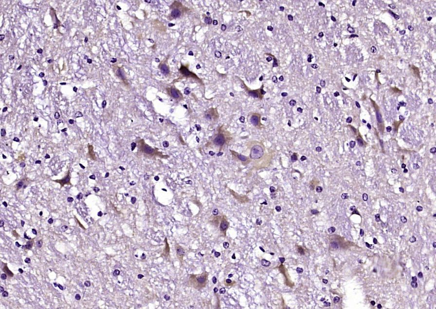 Fig3: Paraformaldehyde-fixed, paraffin embedded (mouse cerebellum tissue); Antigen retrieval by boiling in sodium citrate buffer (pH6.0) for 15min; Block endogenous peroxidase by 3% hydrogen peroxide for 20 minutes; Blocking buffer (normal goat serum) at 37℃ for 30min; Antibody incubation with (PDZD9) Polyclonal Antibody, Unconjugated at 1:200 overnight at 4℃, followed by operating according to SP Kit(Rabbit) (sp-0023) instructionsand DAB staining.