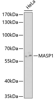 Western blot - MASP1 Polyclonal Antibody 