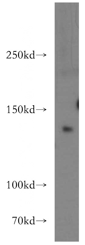mouse brain tissue were subjected to SDS PAGE followed by western blot with Catalog No:113352(OPLAH antibody) at dilution of 1:300