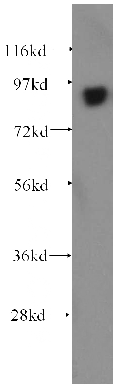 HeLa cells were subjected to SDS PAGE followed by western blot with Catalog No:109368(COG3 antibody) at dilution of 1:500