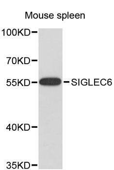 Western blot - SIGLEC6 Polyclonal Antibody 