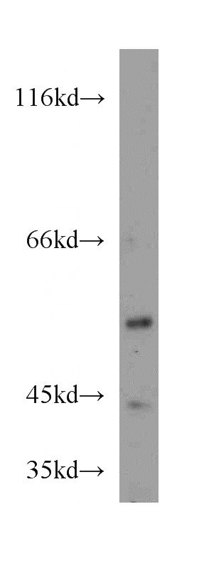 HeLa cells were subjected to SDS PAGE followed by western blot with Catalog No:115485(SNX7 antibody) at dilution of 1:300