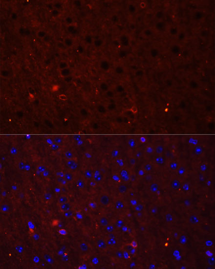 Immunofluorescence - GRIA2 Polyclonal Antibody 