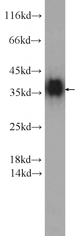 K-562 cells were subjected to SDS PAGE followed by western blot with Catalog No:115176(SGTA antibody) at dilution of 1:800