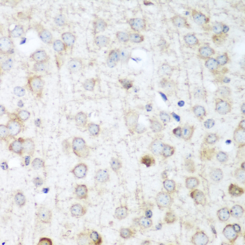 Immunohistochemistry - ANKRD52 Polyclonal Antibody 