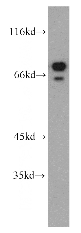 MCF7 cells were subjected to SDS PAGE followed by western blot with Catalog No:107899(AEG-1 antibody) at dilution of 1:1000