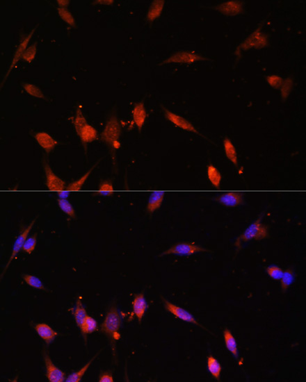 Immunofluorescence - PIK3R3 Polyclonal Antibody 