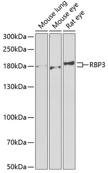 Western blot - RBP3 Polyclonal Antibody 