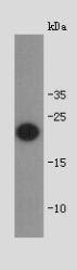 Fig1: Western blot analysis on full length recombinant protein of shiga toxin subunit B using polyclonal antibody.