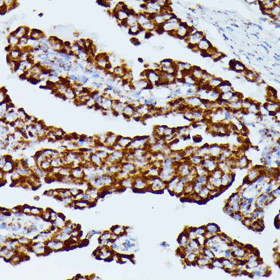Immunohistochemistry - IDH3A Polyclonal Antibody 