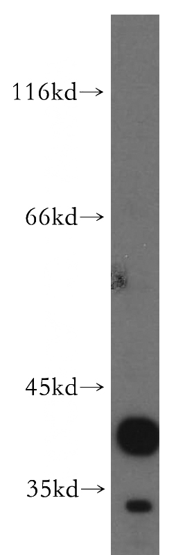 mouse lung tissue were subjected to SDS PAGE followed by western blot with Catalog No:108931(CANT1 antibody) at dilution of 1:300