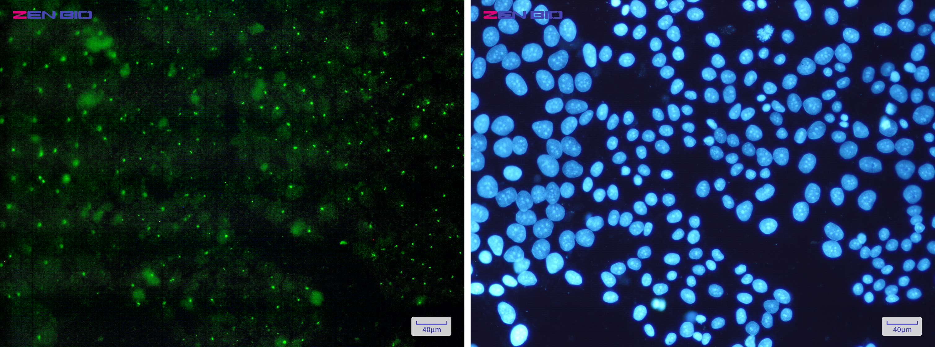 Immunocytochemistry of Aryl hydrocarbon Receptor(green) in Hela cells using Aryl hydrocarbon Receptor Rabbit pAb at dilution 1/50, and DAPI(blue)