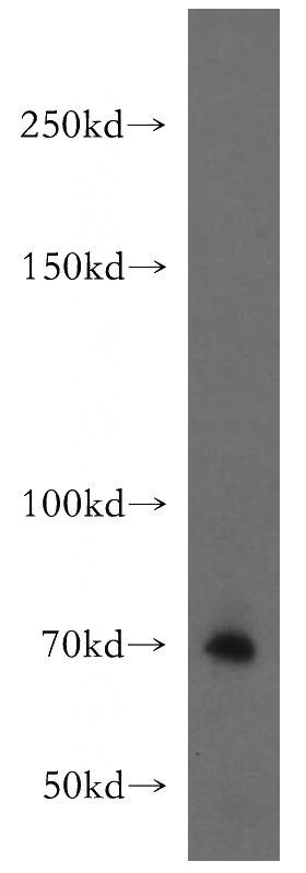 mouse brain tissue were subjected to SDS PAGE followed by western blot with Catalog No:110536(FBF1 antibody) at dilution of 1:400