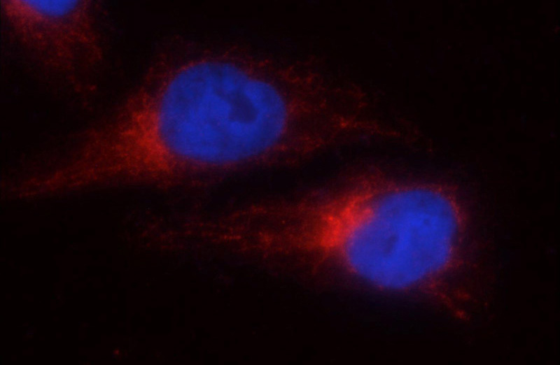 Immunofluorescent analysis of HepG2 cells using Catalog No:111221(GRP78,BIP Antibody) at dilution of 1:25 and Rhodamine-Goat anti-Rabbit IgG