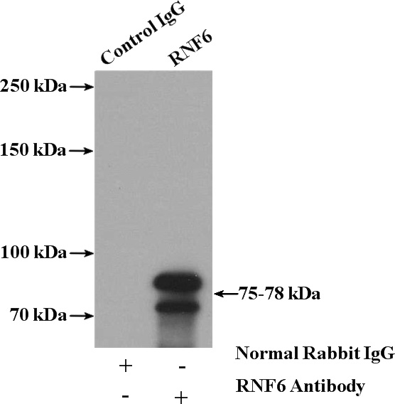 IP Result of anti-RNF6 (IP:Catalog No:114762, 4ug; Detection:Catalog No:114762 1:800) with mouse testis tissue lysate 4000ug.