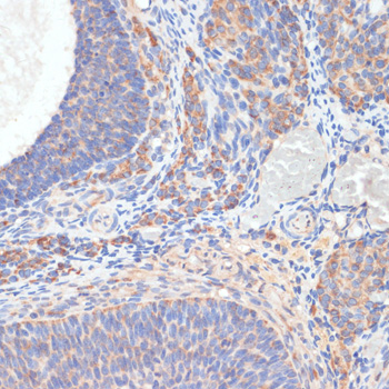Immunohistochemistry - TES Polyclonal Antibody 