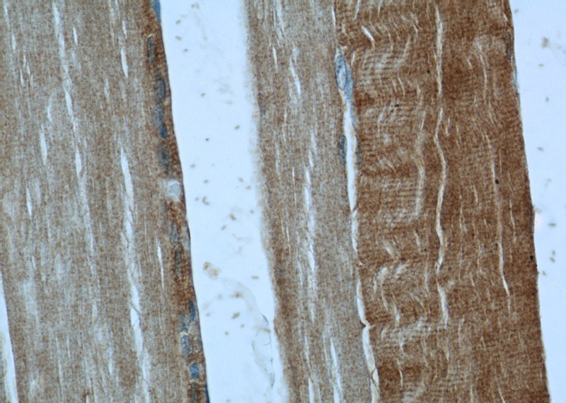 Immunohistochemistry of paraffin-embedded human skeletal muscle tissue slide using Catalog No:113772(PFKM Antibody) at dilution of 1:50 (under 40x lens)