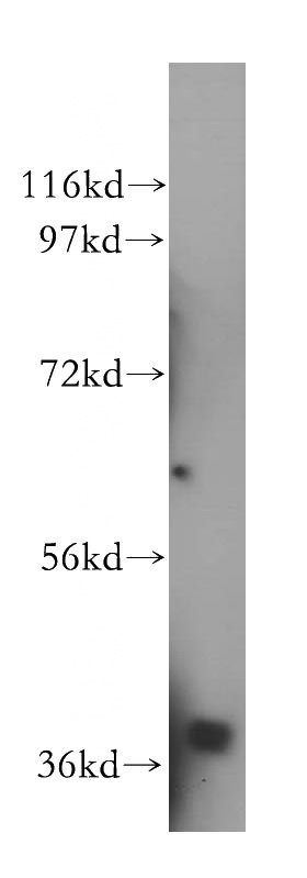 human brain tissue were subjected to SDS PAGE followed by western blot with Catalog No:113016(NAGK antibody) at dilution of 1:500