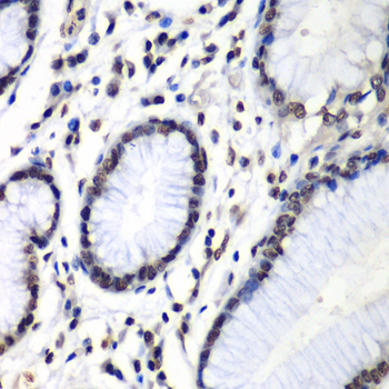 Immunohistochemistry - HNRNPM Polyclonal Antibody 