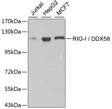 Western blot - RIG-I / DDX58 Polyclonal Antibody 
