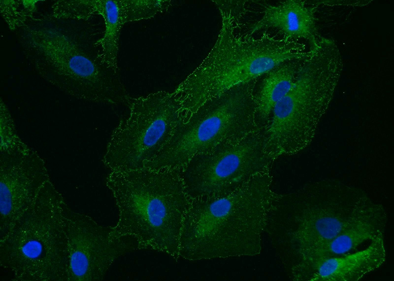 Immunofluorescent analysis of A549 cells using Catalog No:115729(STOM Antibody) at dilution of 1:25 and Alexa Fluor 488-congugated AffiniPure Goat Anti-Rabbit IgG(H+L)